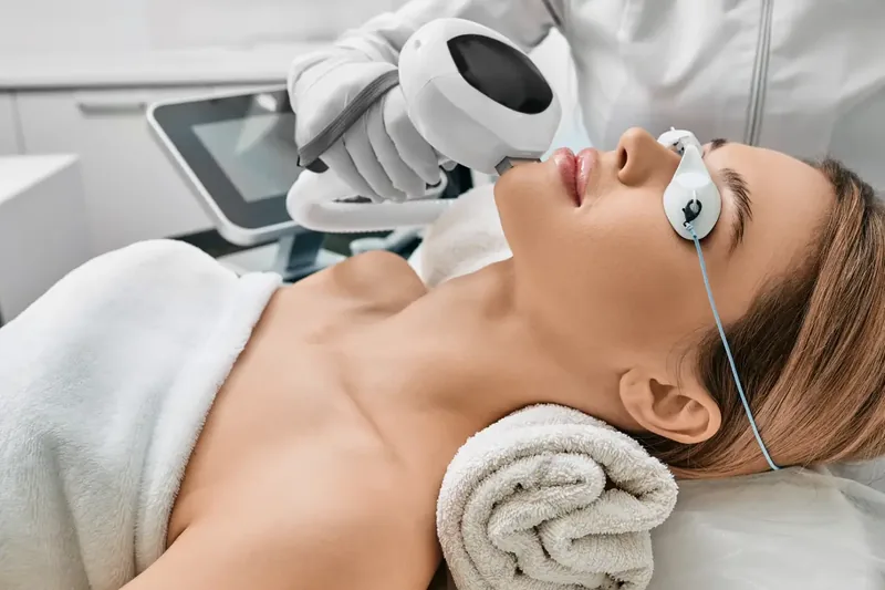 IPL Photofacial